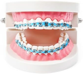 Close up view of the light blue dental brackets and wire components for student training
