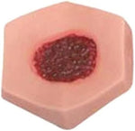 LUCKFY medical student wound care kit with interchangeable ulcer stages.