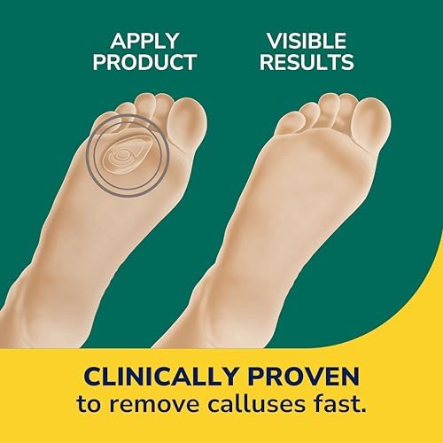 Back of packaging showing instructions for Duragel callus remover patches.