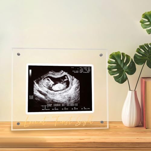 DEYIXUN imported USA baby sonogram frame styled as a nursery room decoration gift