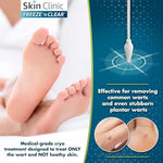 The complete components of the Skin Clinic wart remover kit including standard and ultra-precise tips.