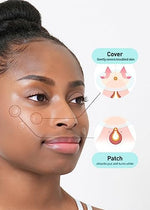 Transparent matte finish of Olive Young spot cover on skin
