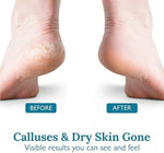 Gilden Tree 40 percent urea cream for feet maximum strength exfoliation and moisturizing.