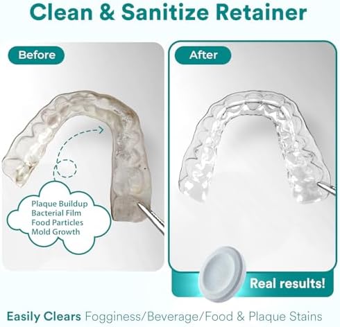 Persulfate free aligner cleaning tablets showing packaging details and thirty count supply