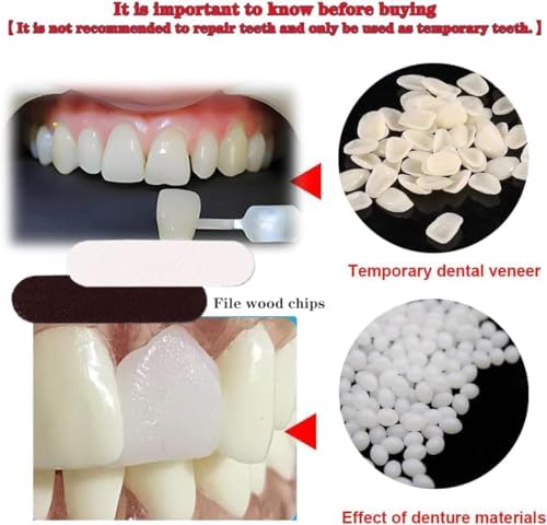 The content layout of the VEZE temporary dental replacement kit including fake teeth veneers and thermal granules.