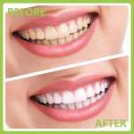 High quality stainless steel dental tools for personal and pet oral care.