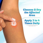 First aid kit essential hydrocortisone cream for poison ivy and oak relief.