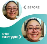Temptooth kit box showing smile transformation results