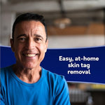 Dermatologist proven skin tag freezing method for home use packaging
