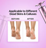Wygleam portable pedicure tool with USB charging cable and sanding discs.