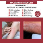 Quatriderm NF paraben-free anti-itch cream tube with aloe vera