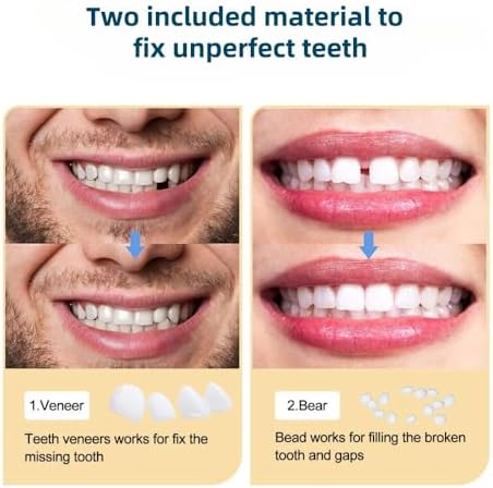 Thermal beads for teeth repair in a container