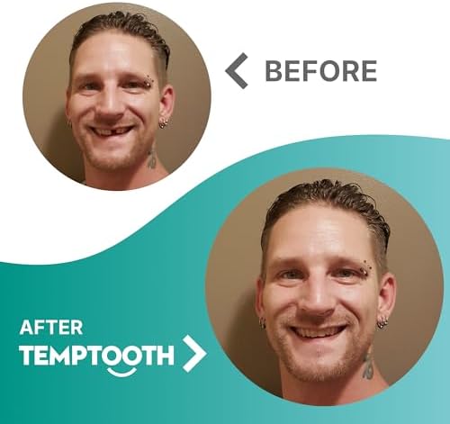 Temptooth instructions and tool set for temporary tooth