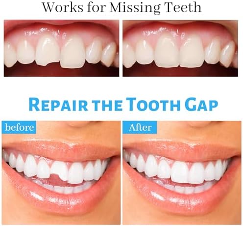 Before and after demonstration using moldable dental beads to fix a missing front tooth gap.