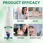 Ginolmis antimicrobial foot spray being applied to skin for odor control.