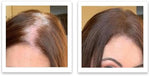 Instructions on how to apply Caboki powder to bald spots