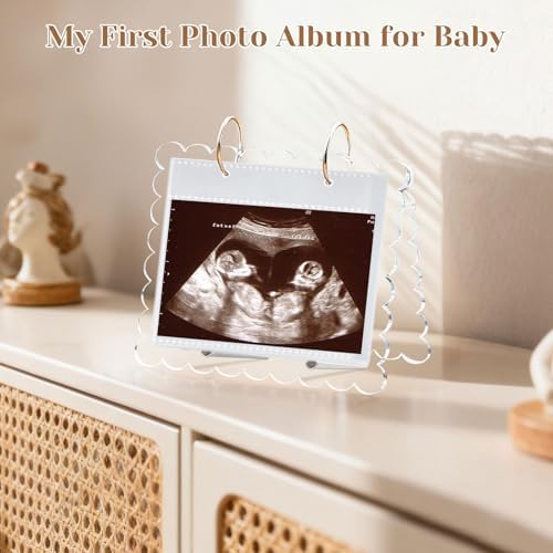 Mlatnod baby sonogram display book showing open calendar style pages with three by four inch picture
