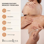 BellamiLuxx treatment for fungal folliculitis and itchy bumps on skin