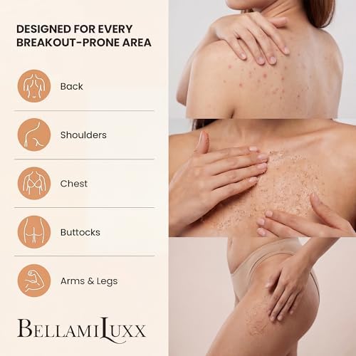BellamiLuxx treatment for fungal folliculitis and itchy bumps on skin