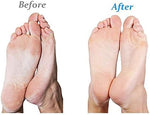 Full kit view of Emjoi callus remover with cleaning brush and replacement rollers.