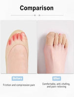 Fizzest breathable toe caps applied to a foot for pain relief.