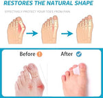 Close up of soft flexible gel material of the Nolimvita hammer toe splint.