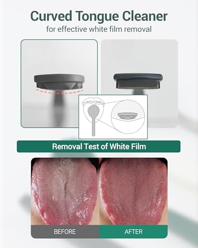 Ergonomic white handle of DEARCUS tongue scraper for breath freshening