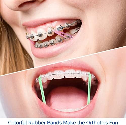 Three green plastic elastic placers next to scattered transparent orthodontic bands