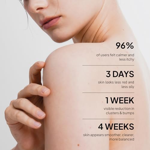 BellamiLuxx skin care for oily skin and yeast prone breakouts with zinc PCA