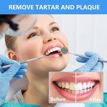 Dental tartar scraper and plaque remover tool close up