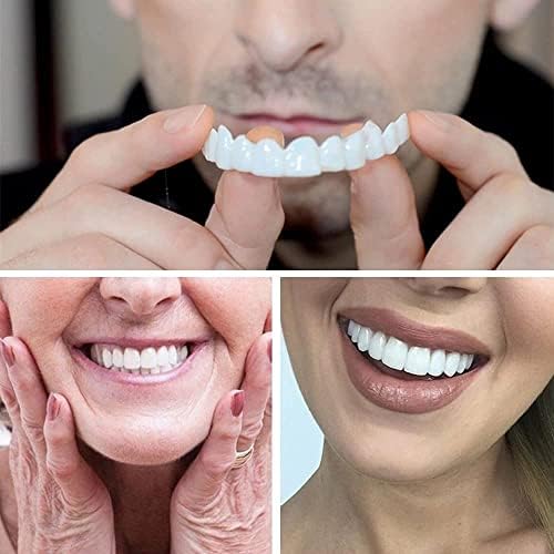 Denture teeth kit for covering gaps and stained teeth