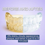 Venus Visage clear aligner cleaner kit showcasing the included blue retainer removal tool and packaging