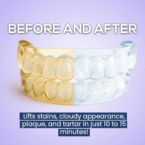 Venus Visage clear aligner cleaner kit showcasing the included blue retainer removal tool and packaging