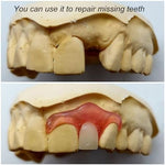 Brige thermal fitting polymer for temporary tooth replacement