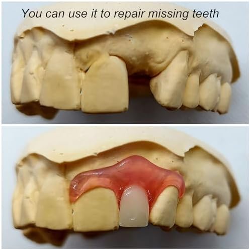 Brige thermal fitting polymer for temporary tooth replacement