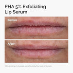 Hydrating lip treatment for dark lips and improved texture with gentle chemical acids