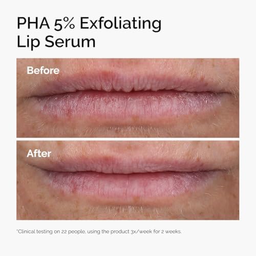 Hydrating lip treatment for dark lips and improved texture with gentle chemical acids