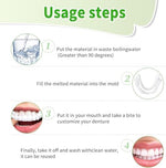 Care Spring veneers kit contents displayed on a white background.