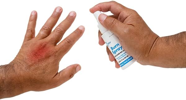 Globe topical anesthetic burn spray for minor scalds and scrapes application