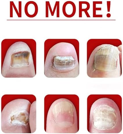 Natural botanical nail treatment providing assistance with restoring damaged nail plates