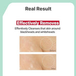 Applying Illiyoon cleansing oil to face