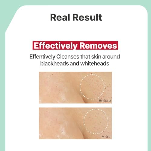 Applying Illiyoon cleansing oil to face