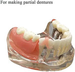 Close up of moldable gum material for tooth repair