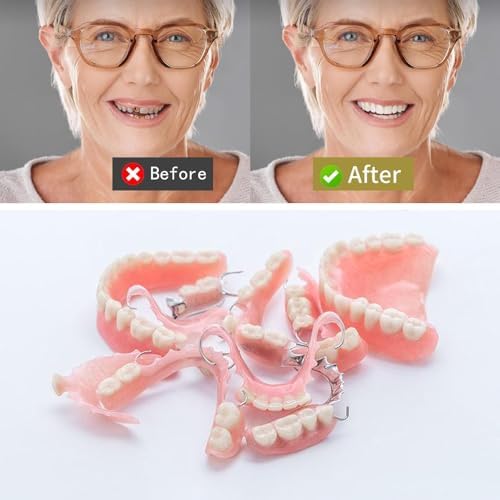 Close up of pink dental molding material for partial dentures