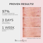 BellamiLuxx plant based skin treatment cream for clearing body breakouts