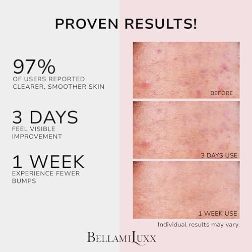 BellamiLuxx plant based skin treatment cream for clearing body breakouts
