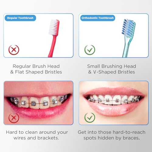 Full set of Fregum orthodontic care tools