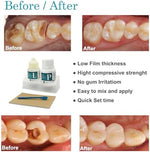 Complete packaging of Longkason temporary crown bridge and cap filling kit for emergency home dental support.