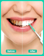 Side profile view of the premium silicone interdental brush showcasing the ergonomic long handle design for precise control during teeth cleaning.