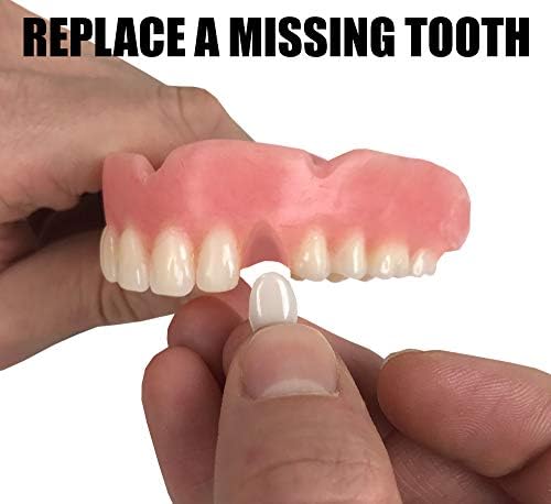 Replacement teeth veneers included in the Instant Smile repair kit